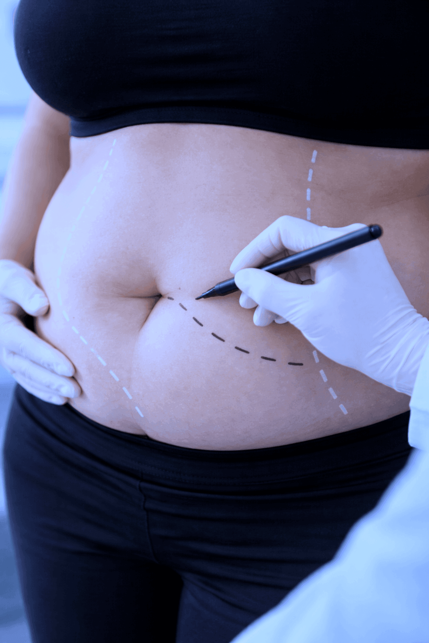 Obesity Center and Bariatric Surgery